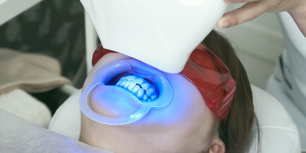 ホワイトニング治療で歯が痛くなる原因