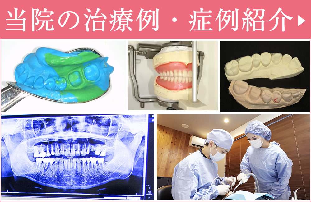 症例・治療例