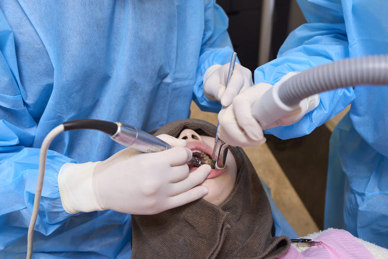 口腔外科・親知らず治療