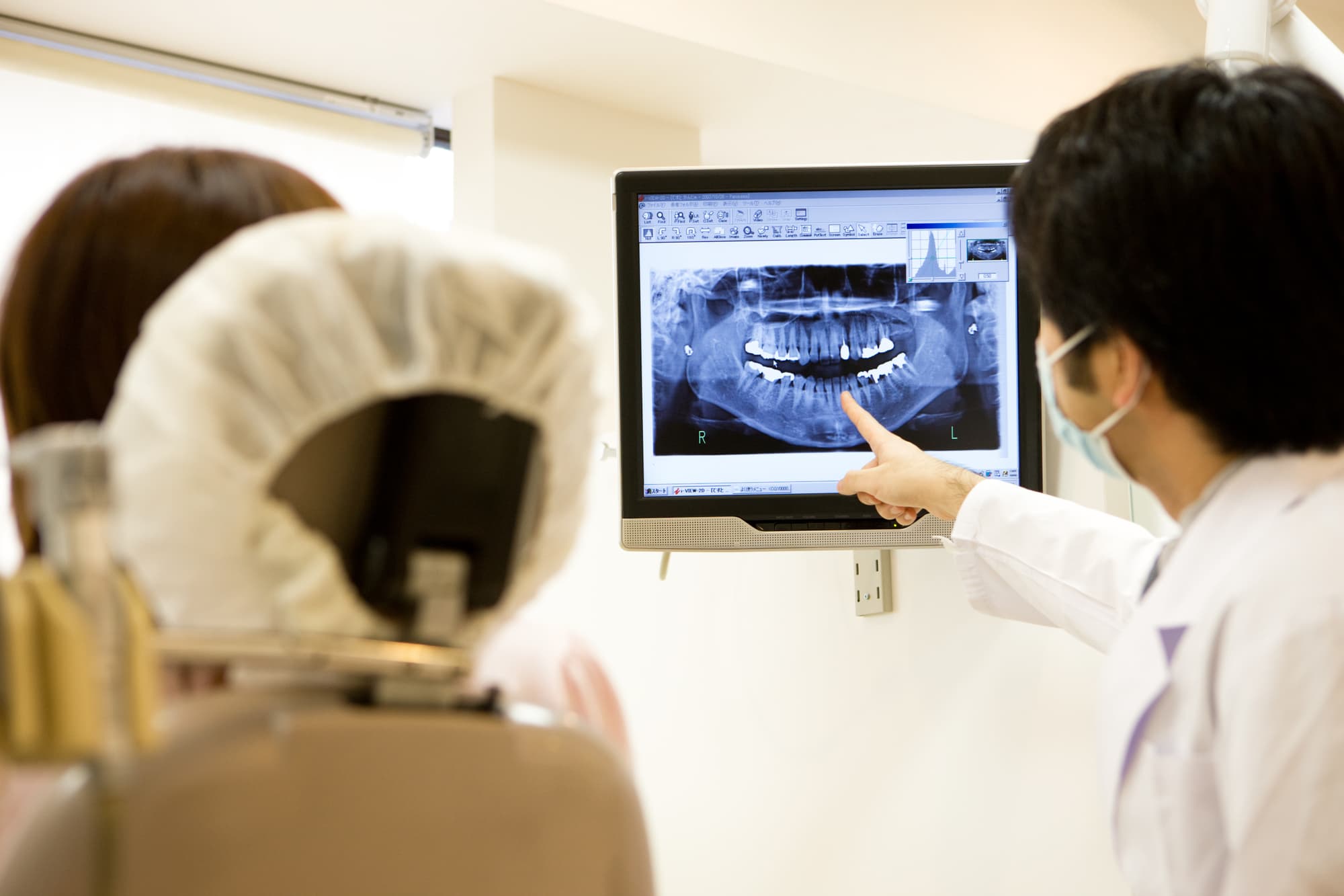 撮影したレントゲン写真を指さし説明する歯科医師