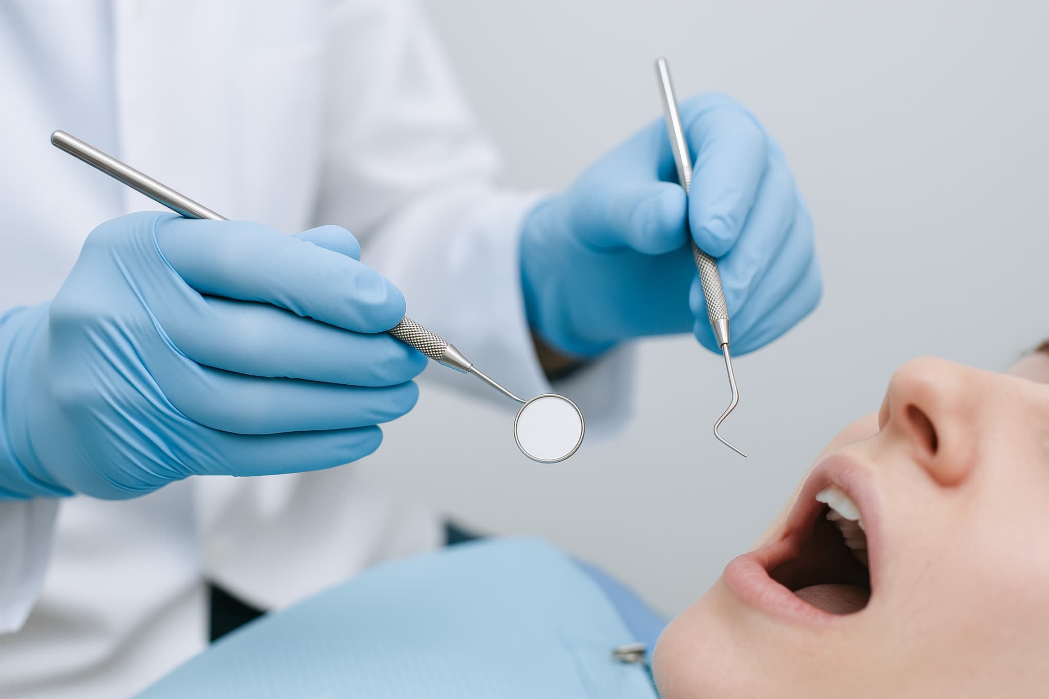 予防歯科の様子