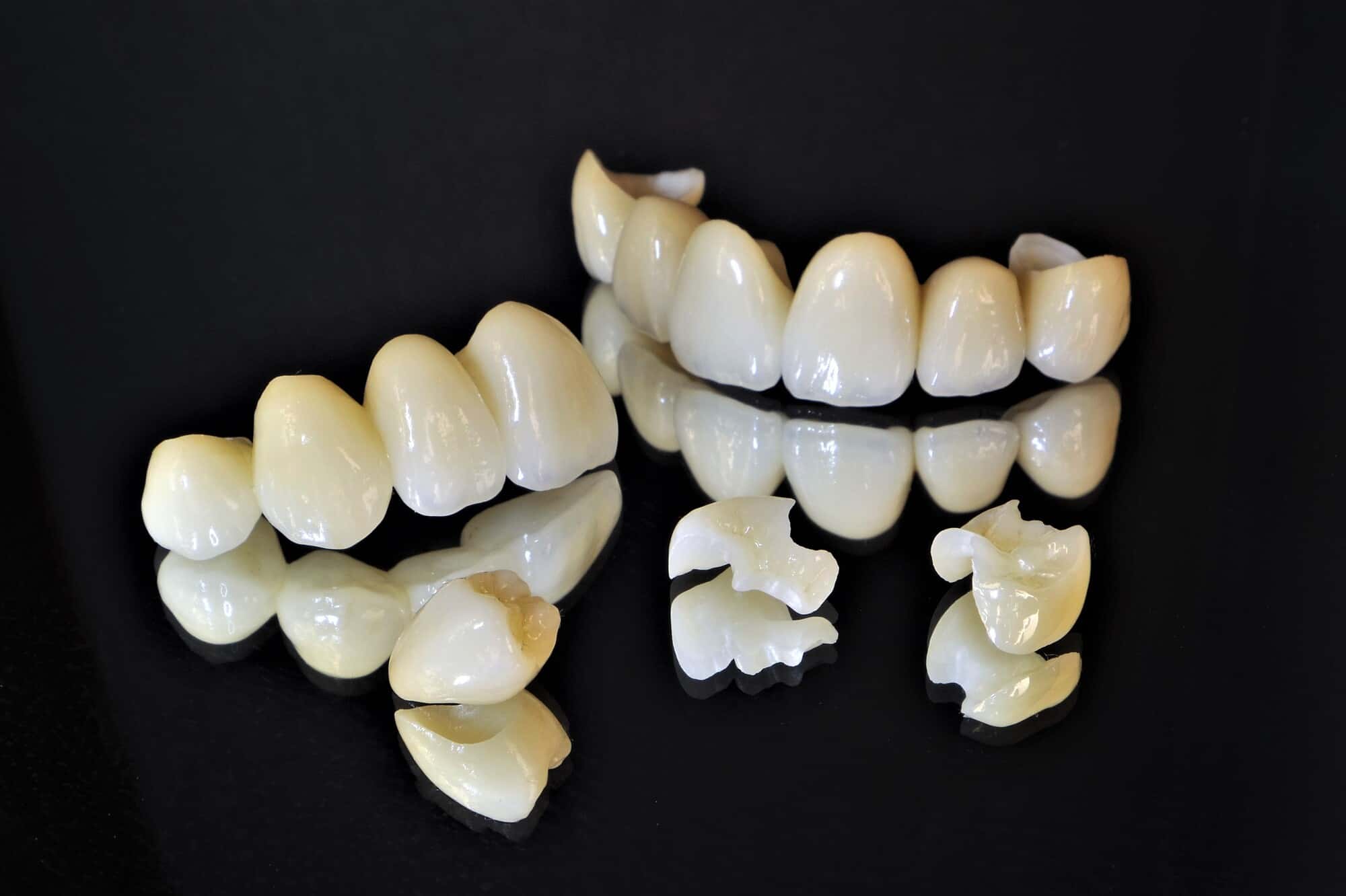 ブリッジやインレーなどのセラミックの歯