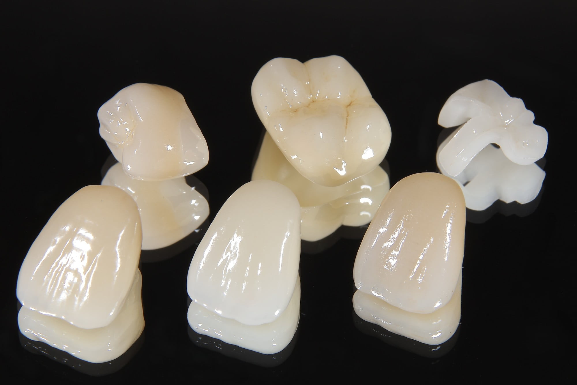 色々な素材でできたセラミックの歯