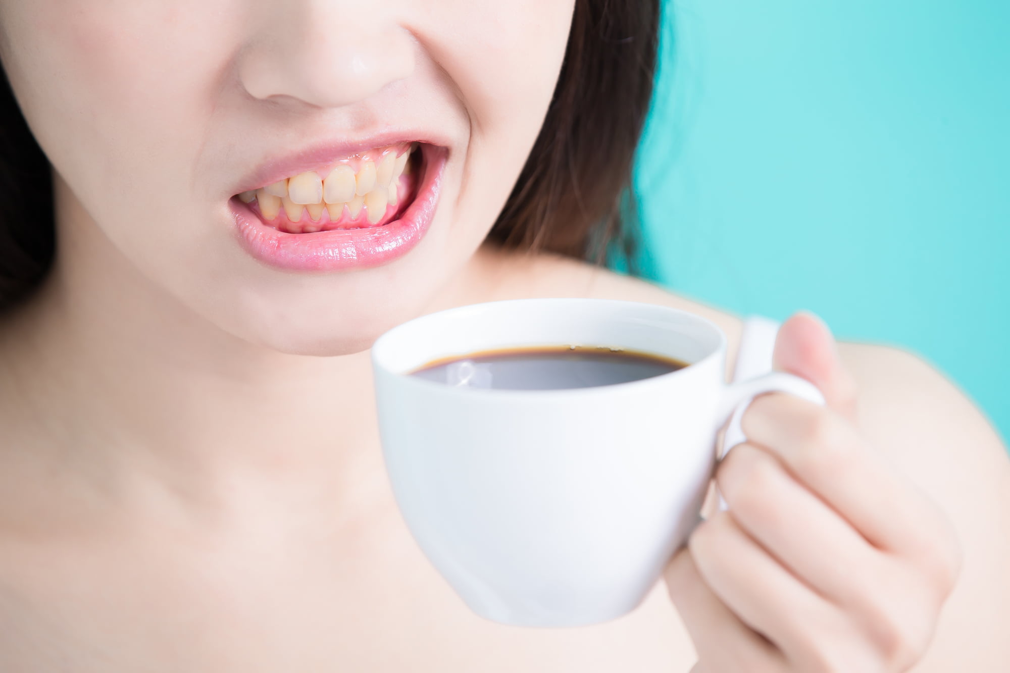 コーヒーを飲んで歯に着色した女性